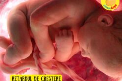 Retardul de creștere intrauterină in sarcină: diagnostic, cauze, efecte și recomandări – sfatul medicului.