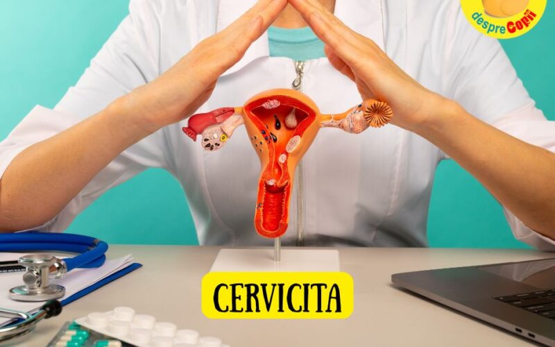 Cervicita: Ce este, cauze, simptome și tratament